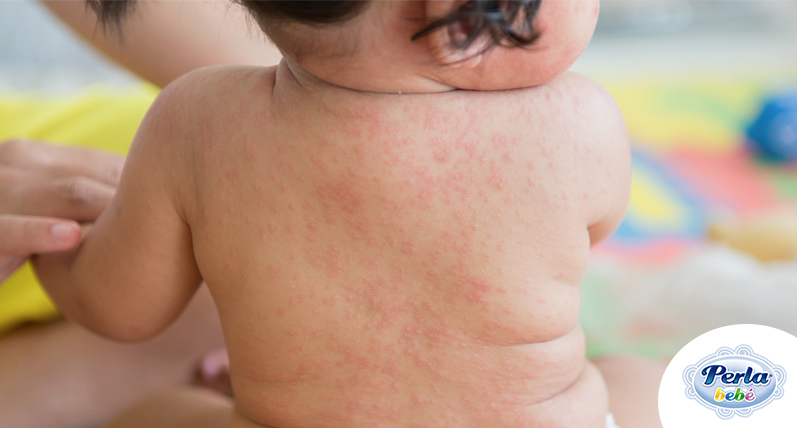 roseola en los bebes